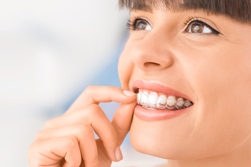 Invisalign in Los Altos